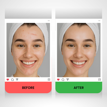 Collagenex - Collagen Tape