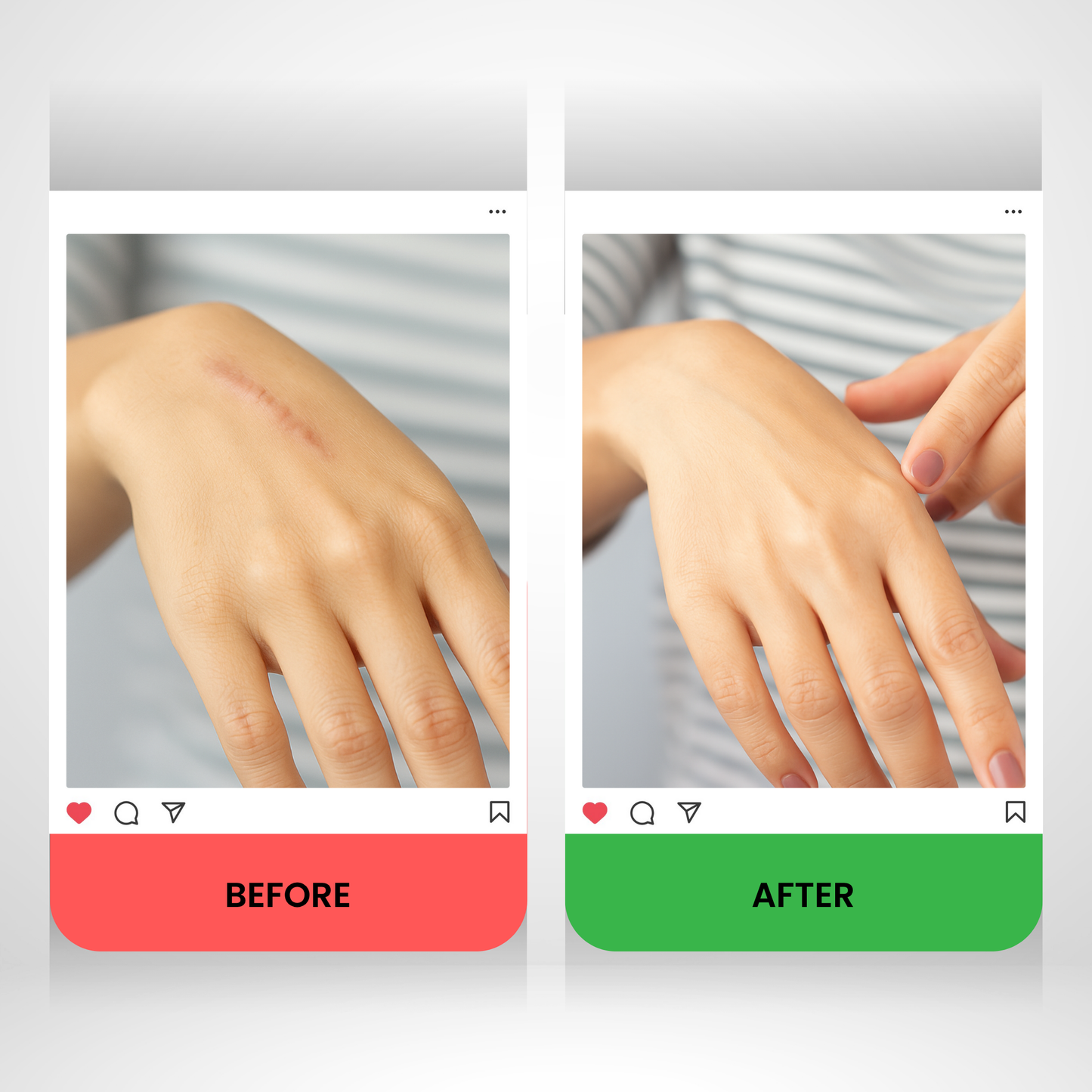 Collagenex - Collagen Tape