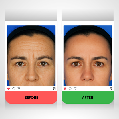 Collagenex - Collagen Tape