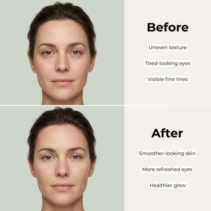 AUREL - Eye Revival Pen