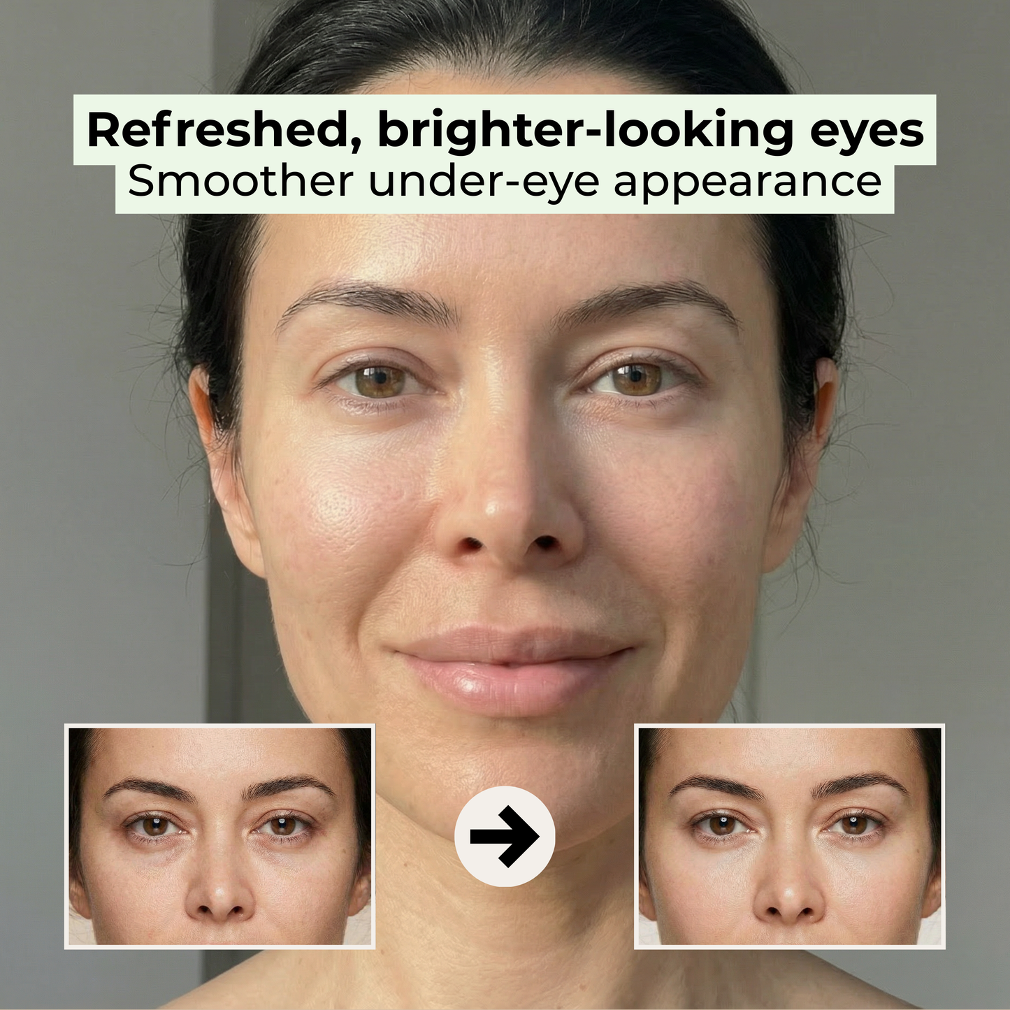 AUREL - Eye Revival Pen